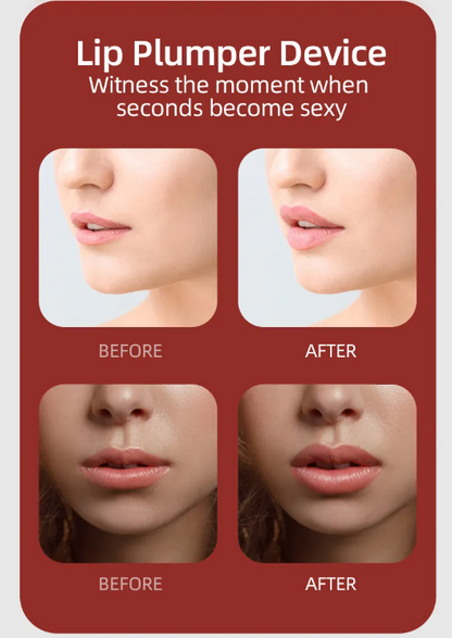 Electric Silicone Lip Plumper & Enhancer – Fuller, Plumper Lips in Minutes